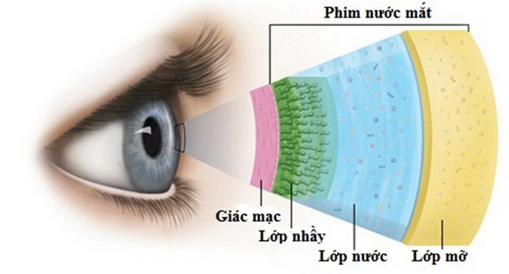 Khô mắt là 1 nguyên nhân gây ngứa mắt.