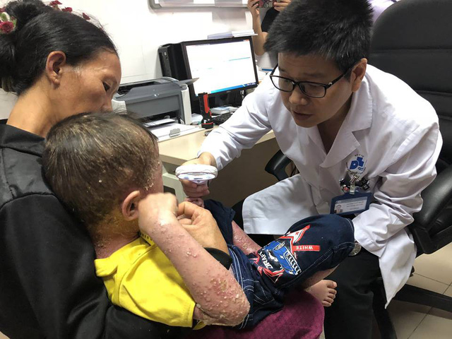 PGS.TS Lê Hữu Doanh đang khám cho bệnh nhân Thuyên. Ảnh: T.G