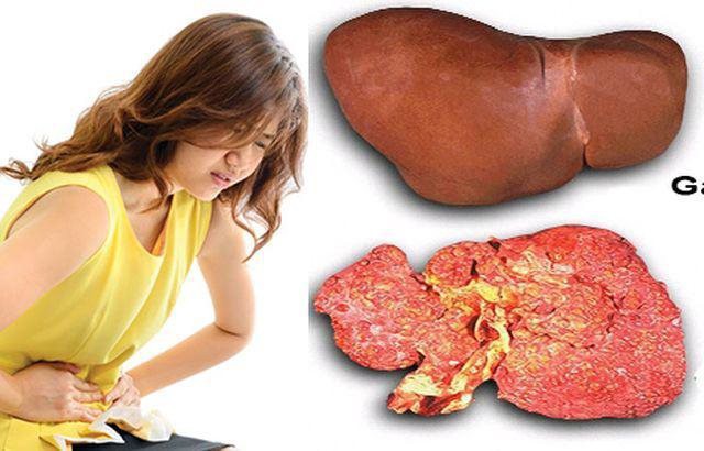 Trẻ nhỏ vẫn bị gan nhiễm mỡ