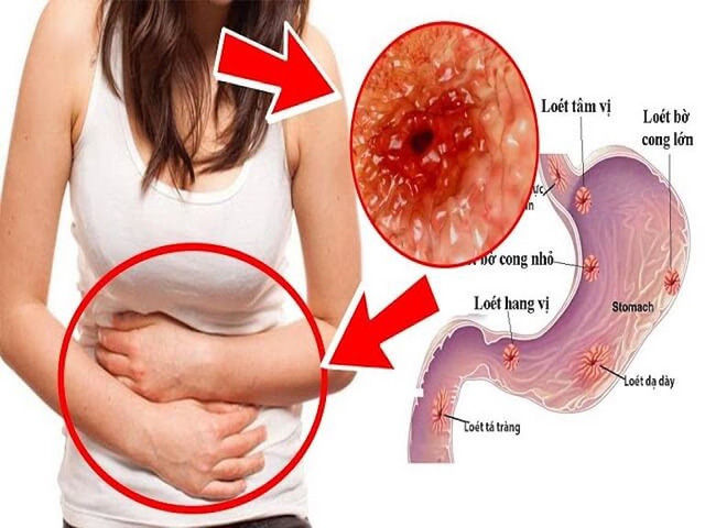 Xuất hiện quầng thâm ở mắt đừng chủ quan, rất có thể bạn đã mắc 1 trong 5 bệnh nguy hiểm này - Ảnh 5.