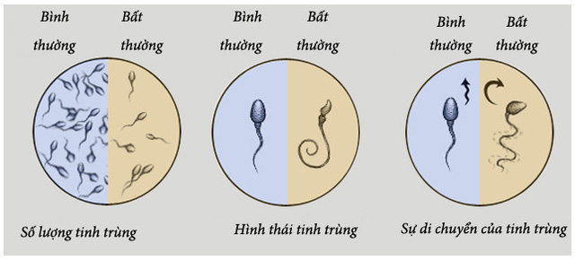Nam giới thường xuyên làm việc này vào ban đêm thì chất lượng tinh trùng kém đi trông thấy, không thay đổi ngay có thể dẫn đến vô sinh - Ảnh 2.