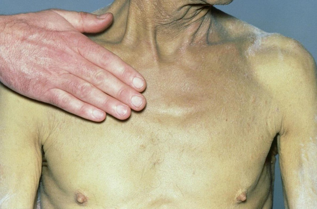 Một vật quen thuộc trong bếp đã khiến hai vợ chồng bị ung thư gan: Hãy kiểm tra vật dụng đó trong nhà bạn, có vấn đề thì bỏ đi ngay - Ảnh 4.