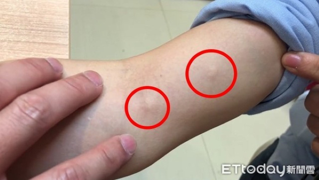 Bác sĩ ấn nhẹ đã thấy tay cô gái nổi nhiều u nang, bạn trai khiếp sợ hỏi có thể kết hôn không, bác sĩ giải đáp thế này - Ảnh 1.
