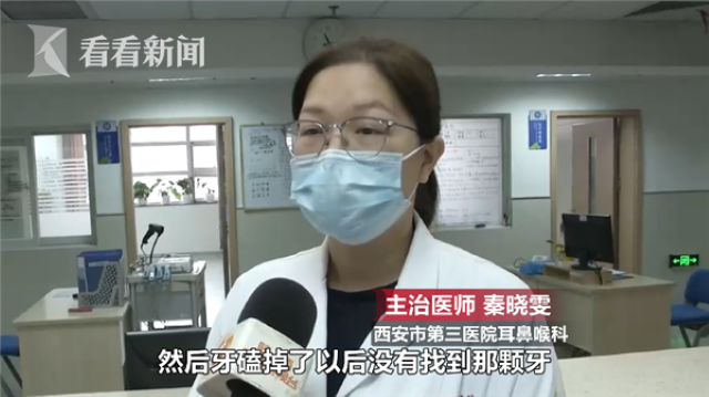 Bé gái có dấu hiệu khó thở, bác sĩ kiểm tra khoang mũi thì phát hiện chiếc răng “thất lạc” từ 3 năm trước - Ảnh 3.