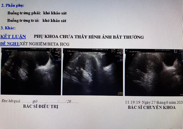 Bác sĩ sản khoa nói gì về trường hợp vác bụng bầu đi đẻ nhưng thực chất không hề có thai? - Ảnh 2.