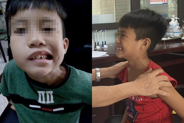 Không muốn liệt mặt, đột tử trong mùa hè thì cả gia đình cần bỏ ngay 5 thói quen dùng điều hòa nguy hại này - Ảnh 1.