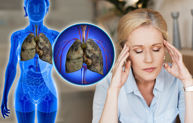 Có 5 dấu hiệu này chứng tỏ phổi của bạn đang kêu cứu, tuyệt đối không được chủ quan - Ảnh 5.