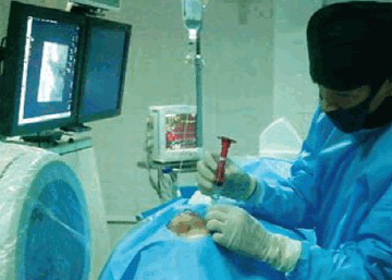 Ngày nay chỉ 30 phút là thoát chứng gió thổi vào mặt cũng đau giật nửa mặt và lấy lại khuôn mặt cân đối - Ảnh 5.