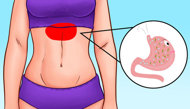 Nếu xuất hiện những dấu hiệu này sau ăn bạn cần đi khám dạ dày gấp - Ảnh 2.