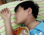 Liệt dây thần kinh số 7 ở trẻ nhỏ, đừng làm điều này nếu không muốn hại con
