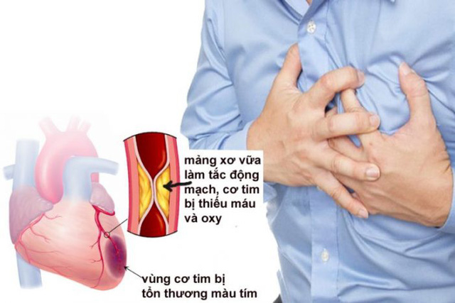 Xét nghiệm định kỳ tại nhà - bí quyết giúp bạn sống khỏe với bệnh mạn tính - Ảnh 1.