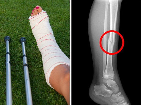 9 dấu hiệu cho thấy bạn nên ngừng uống sữa ngay lập tức - Ảnh 4.