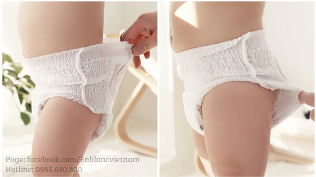 Chọn bỉm thế nào để con không bị hăm trong thời tiết giao mùa - Ảnh 1.