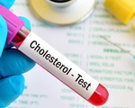 Cứ 10 người Việt trưởng thành thì có đến 3 người thừa cholesterol, nguyên nhân do đâu?