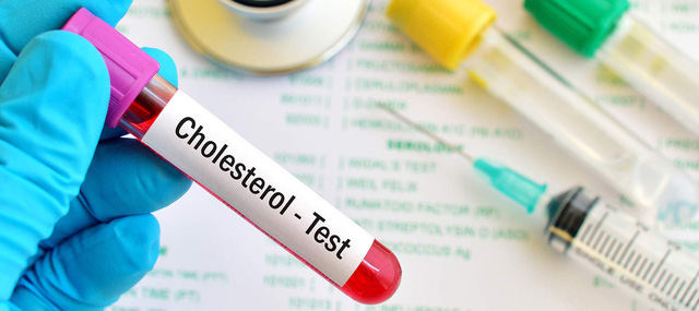Cứ 10 người Việt trưởng thành thì có đến 3 người thừa cholesterol, nguyên nhân do đâu? - Ảnh 2.