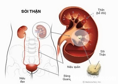 than Các dấu hiệu cho thấy bạn bị đau thận