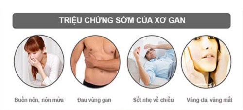 Hoàng Mộc Can với bệnh xơ gan