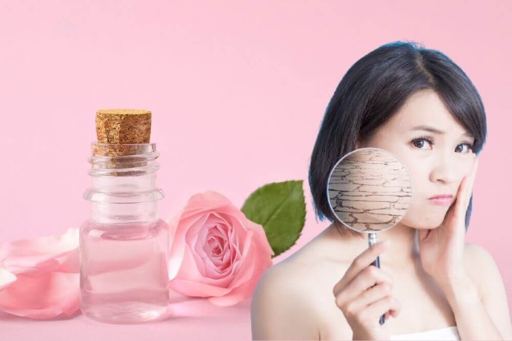 nước hoa hồng cho da nhạy cảm