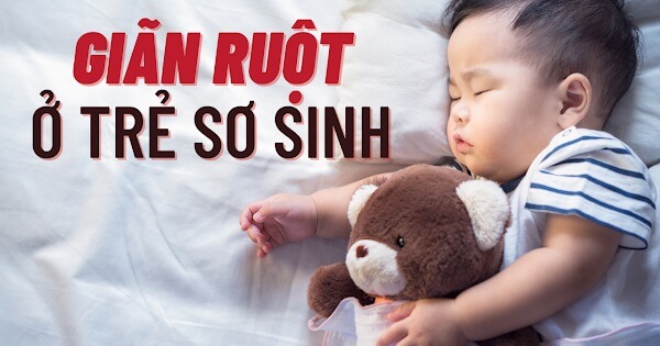 giãn ruột ở trẻ là hiện tượng gì