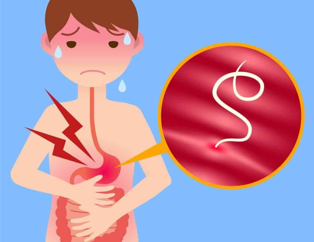 Hậu quả khi không tẩy giun thường xuyên là trẻ không chịu ăn và ăn không ngon miệng