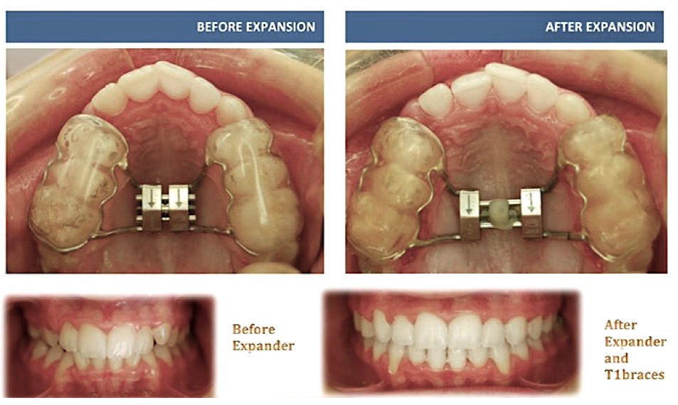 Problems to Watch for in Growing Children
