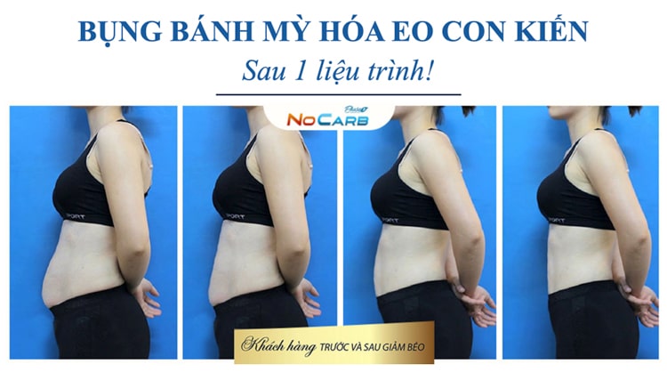 Đối tượng sử dụng thạch giảm cân Nocarb Plus