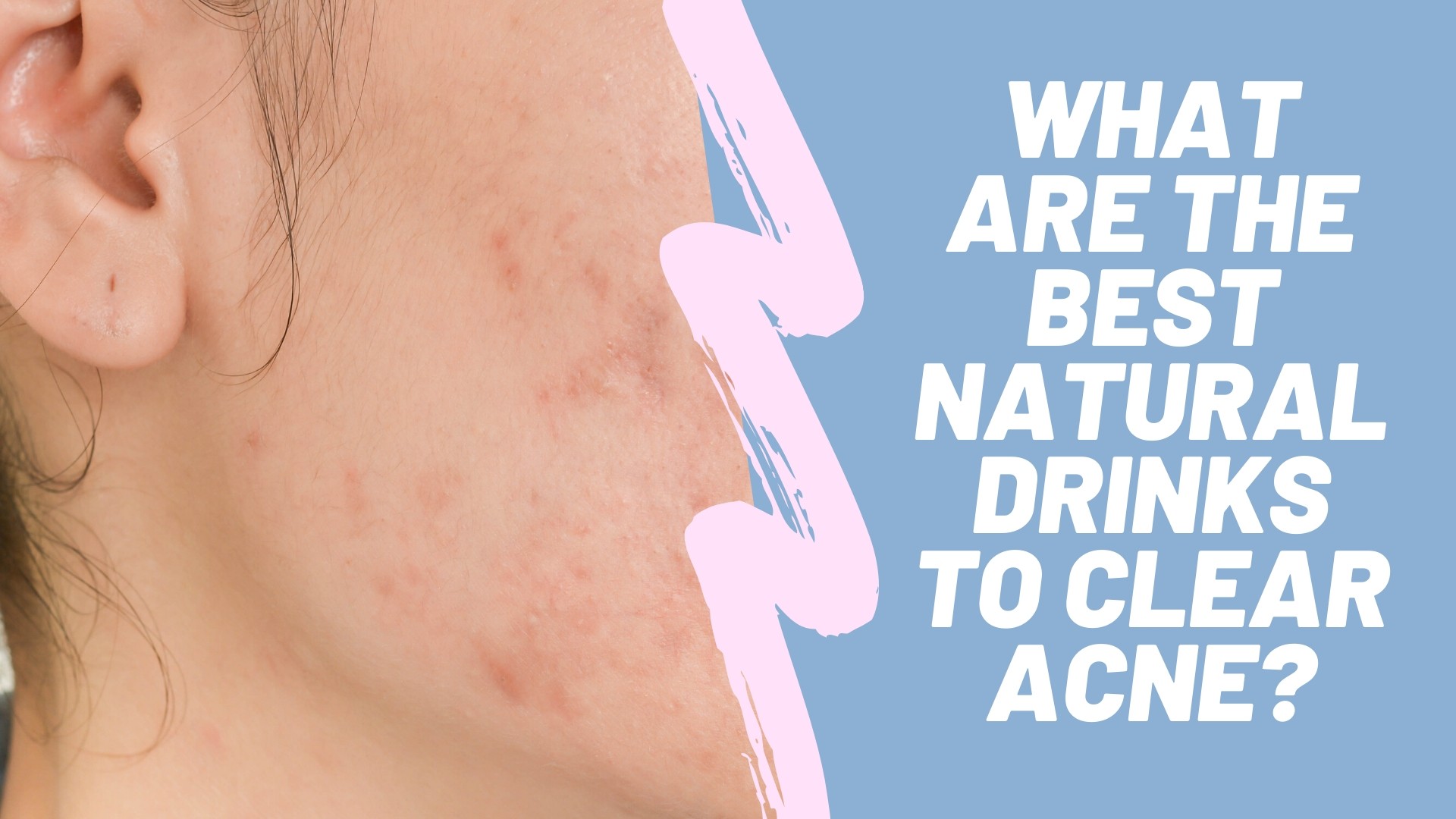 The 7 Natural Drinks For Clear Skin