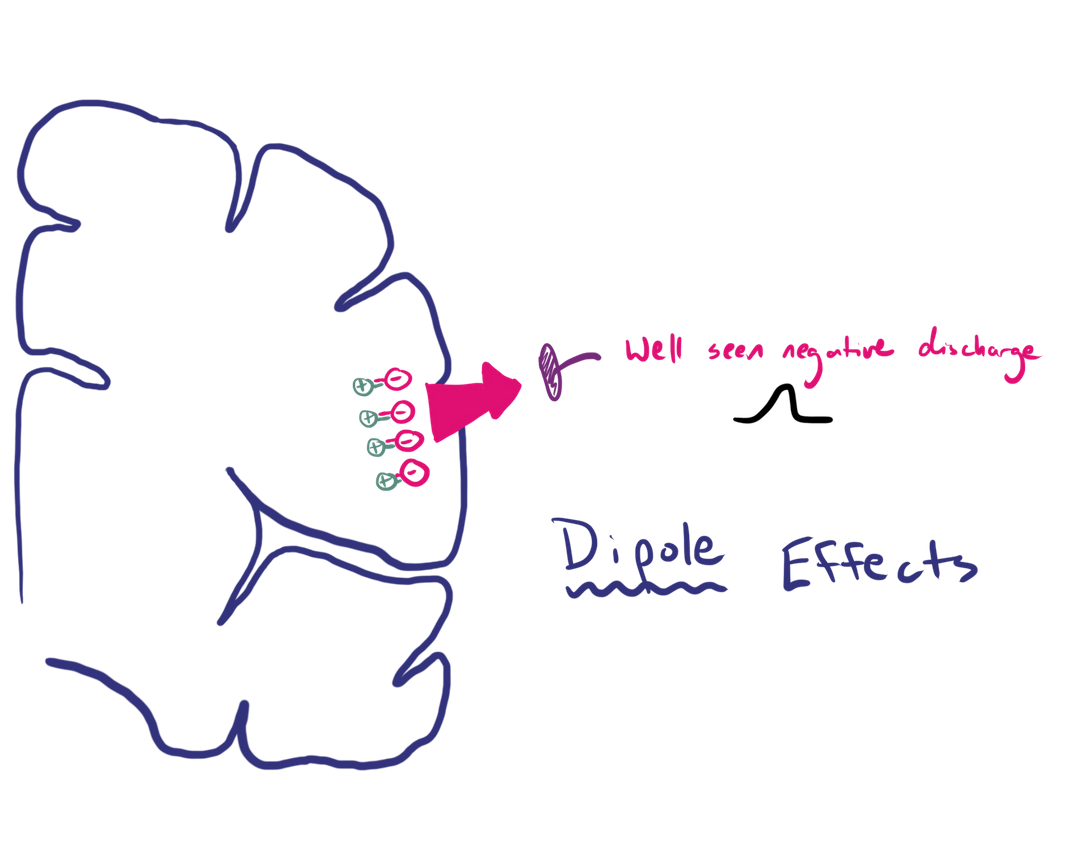 Basic EEG Electrophysiology