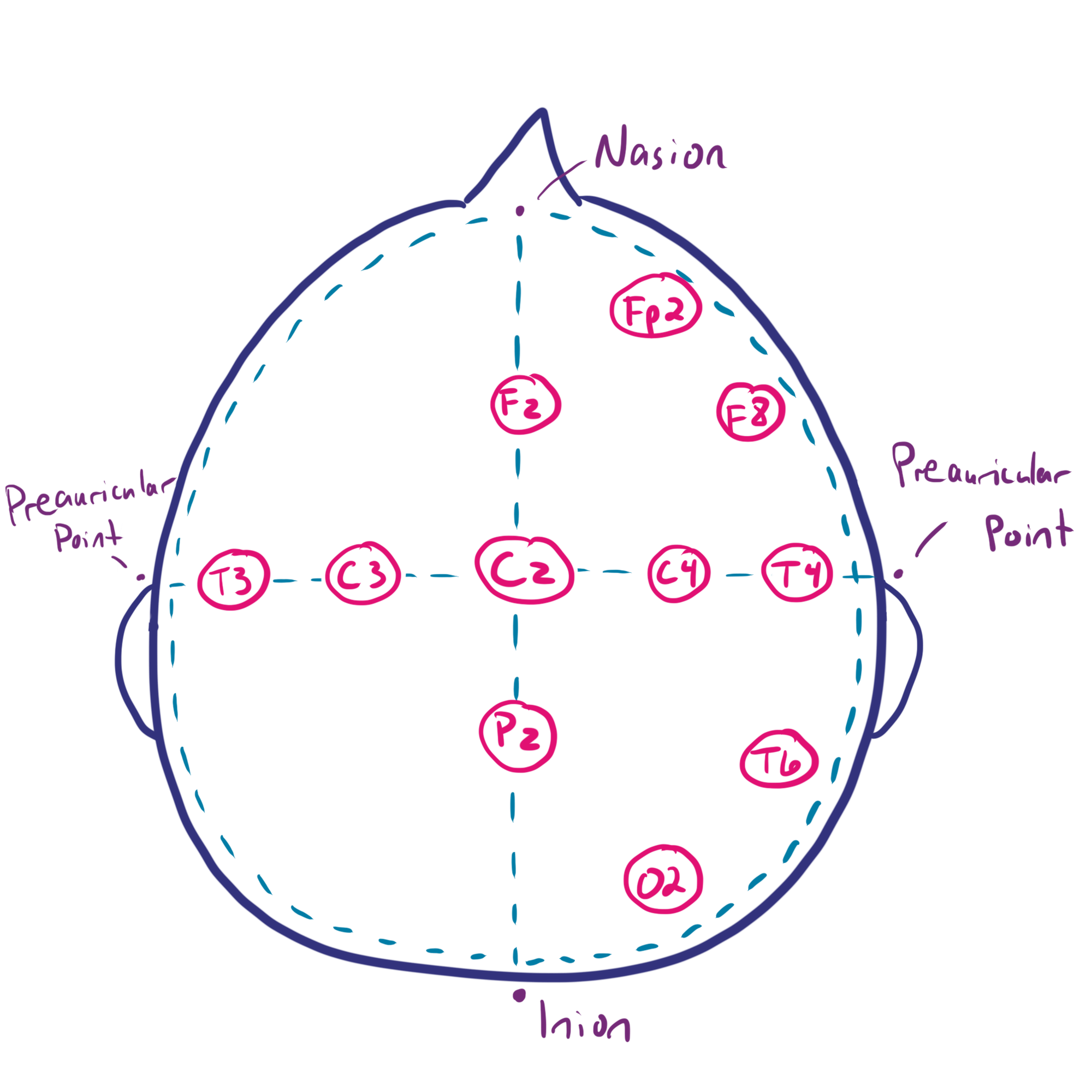 EEG Montages and Technical Components