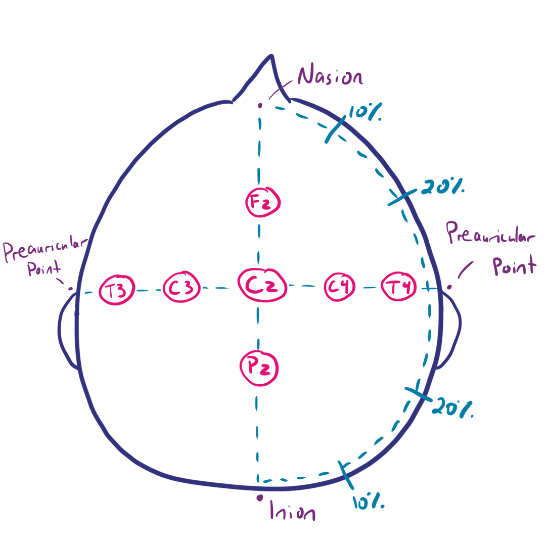 EEG Montages and Technical Components