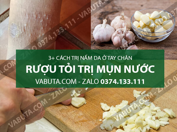 cách trị nấm da tay chân bằng rượu tỏi
