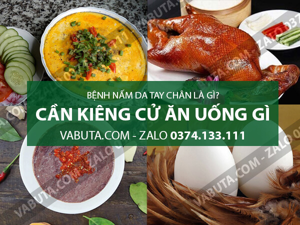 nấm da tay chân cần kiêng gì