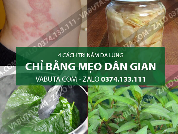 chữa nấm da ở lưng bằng dân gian