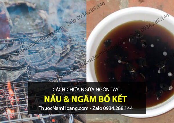 bồ kết trị ngứa đầu ngón tay chân