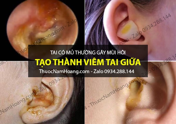 tai có mùi hôi gây khó chịu