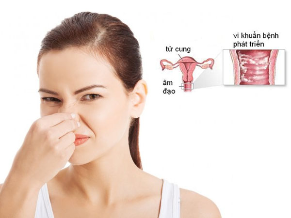 nguyên nhân vùng kín có mùi hôi