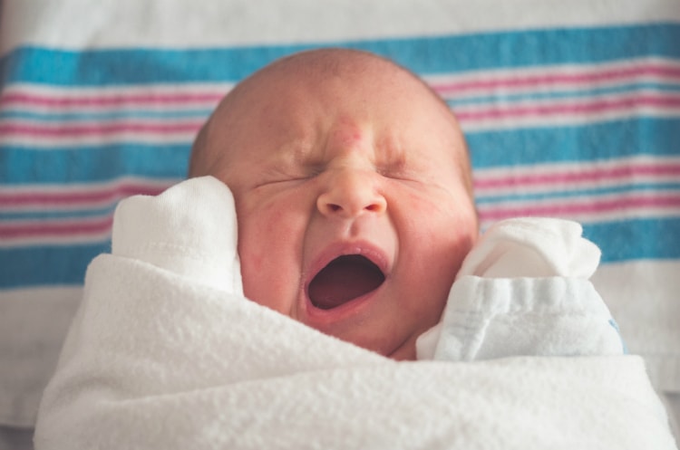 biểu hiện của bé bị chàm sữa