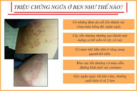 nổi mụn ở bẹn