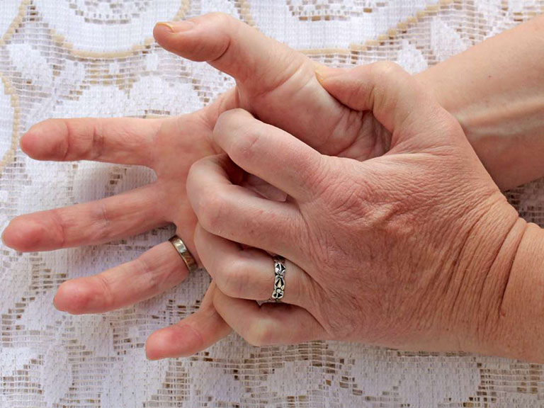 nổi mẫm đỏ ngứa ở tay chân có nguy hiểm không