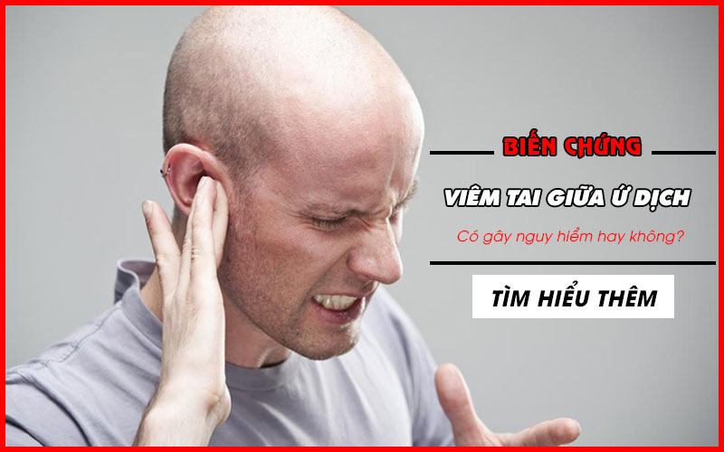 Viêm tai giữa ứ dịch