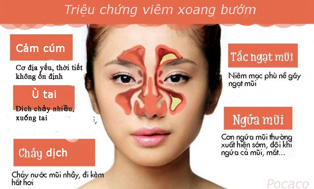 Viêm xoang bướm