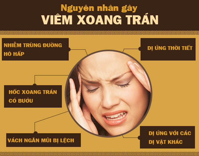 nguyên nhân viêm xoang trán