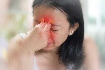 bị viêm xoang cấp có nguy hiểm không