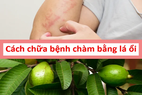 Lá ổi trị chàm da