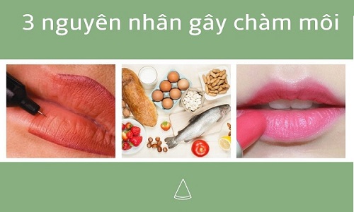 nguyên nhân bị chàm môi