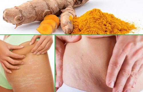 cách trị rạn da bằng nghệ