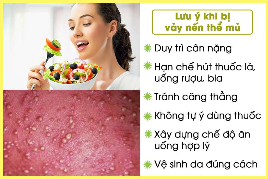 Vảy nến thể mủ toàn thân