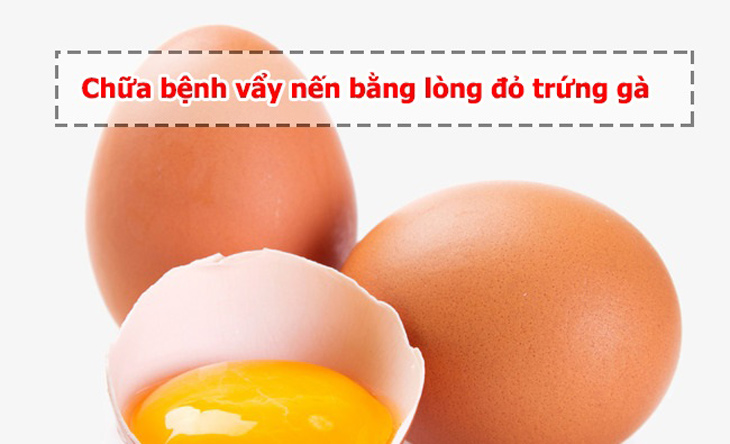 trị vảy nến bằng lòng đỏ trứng gà