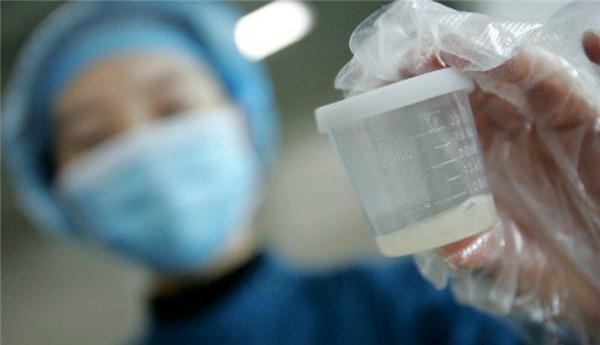 cách kiểm tra chất lượng tinh trùng