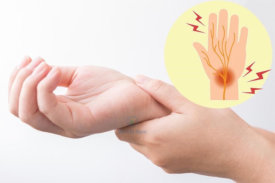 Nhức mỏi chân tay uống thuốc gì